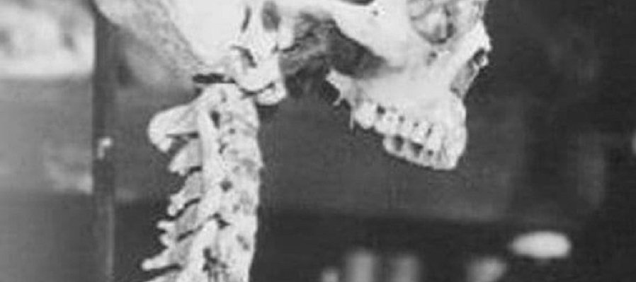 El esqueleto de la señora Morales