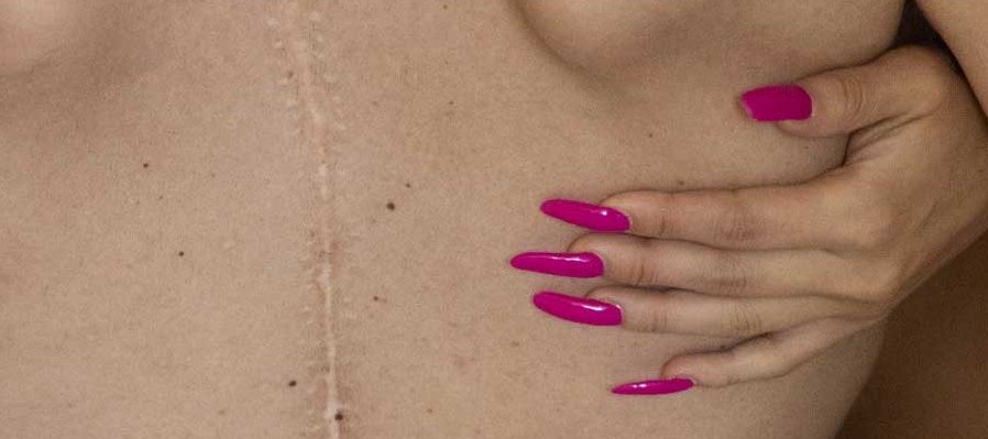 Éticas y estéticas del trabajo sexual
