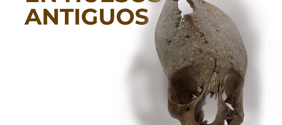 Patologías en huesos antiguos