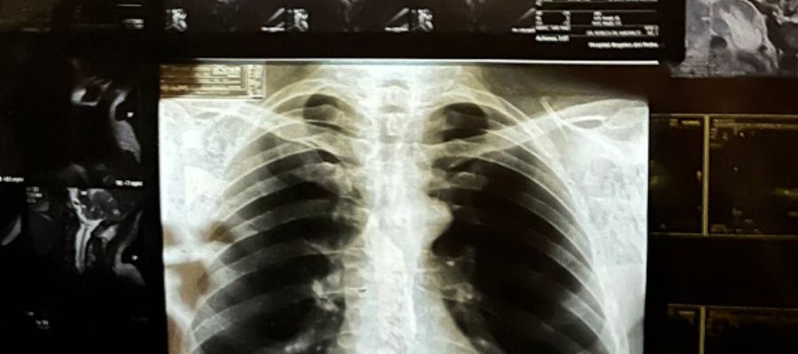 Autoradiográficas: el cuerpo interior