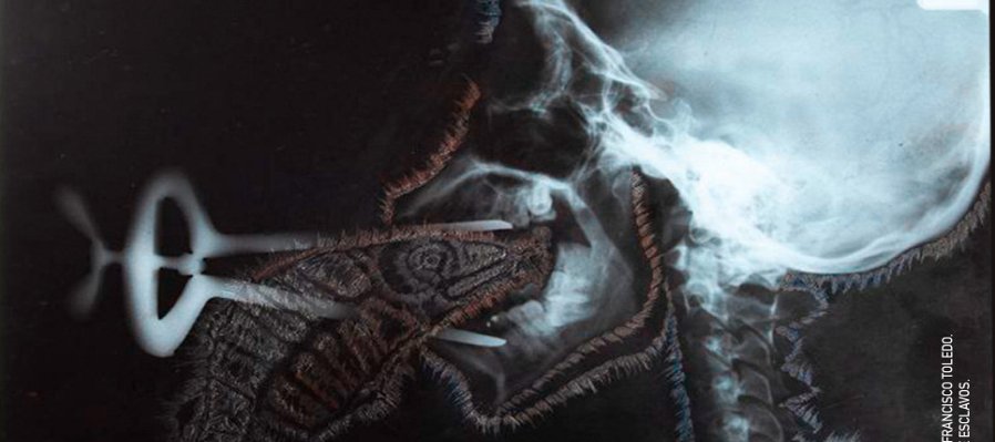 Rayos X Mexicanos. La radiografía como lenguaje expresivo